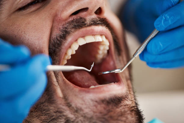 Best Emergency Dental Care for Trauma or Injury in Summit Park, UT